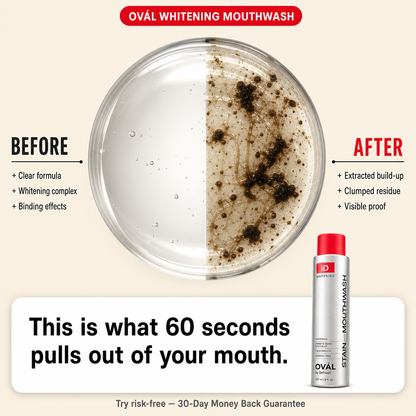 Ovál iD Stain Whitening Mouthwash
